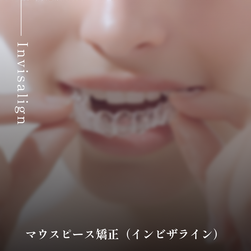 マウスピース矯正(インビザライン)