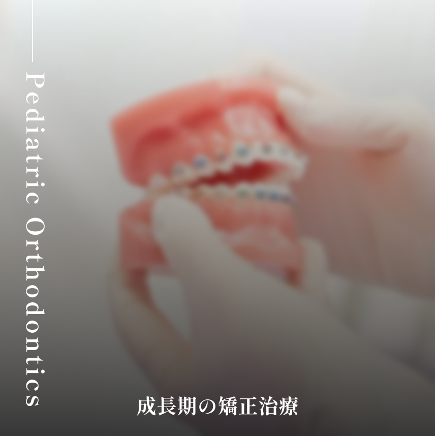 成長期の矯正治療