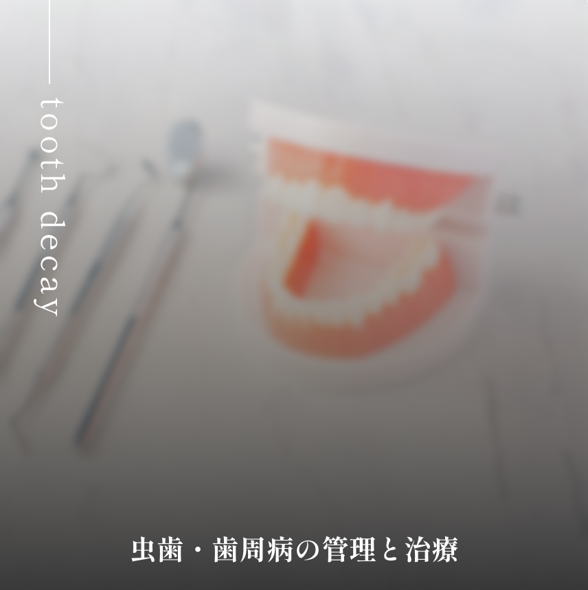 虫歯・歯周病の管理と治療