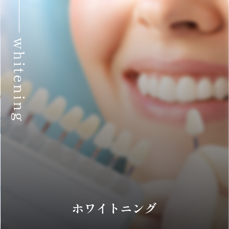 ホワイトニング